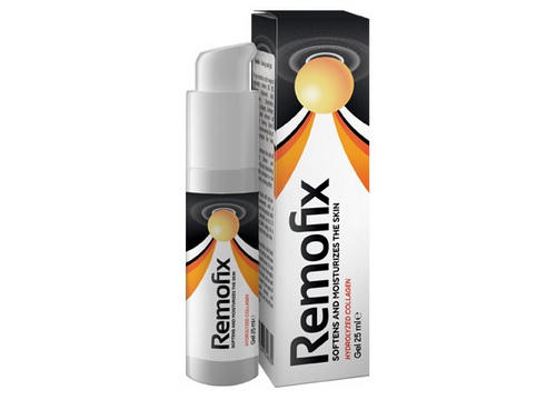 Remofix locītavu gēls